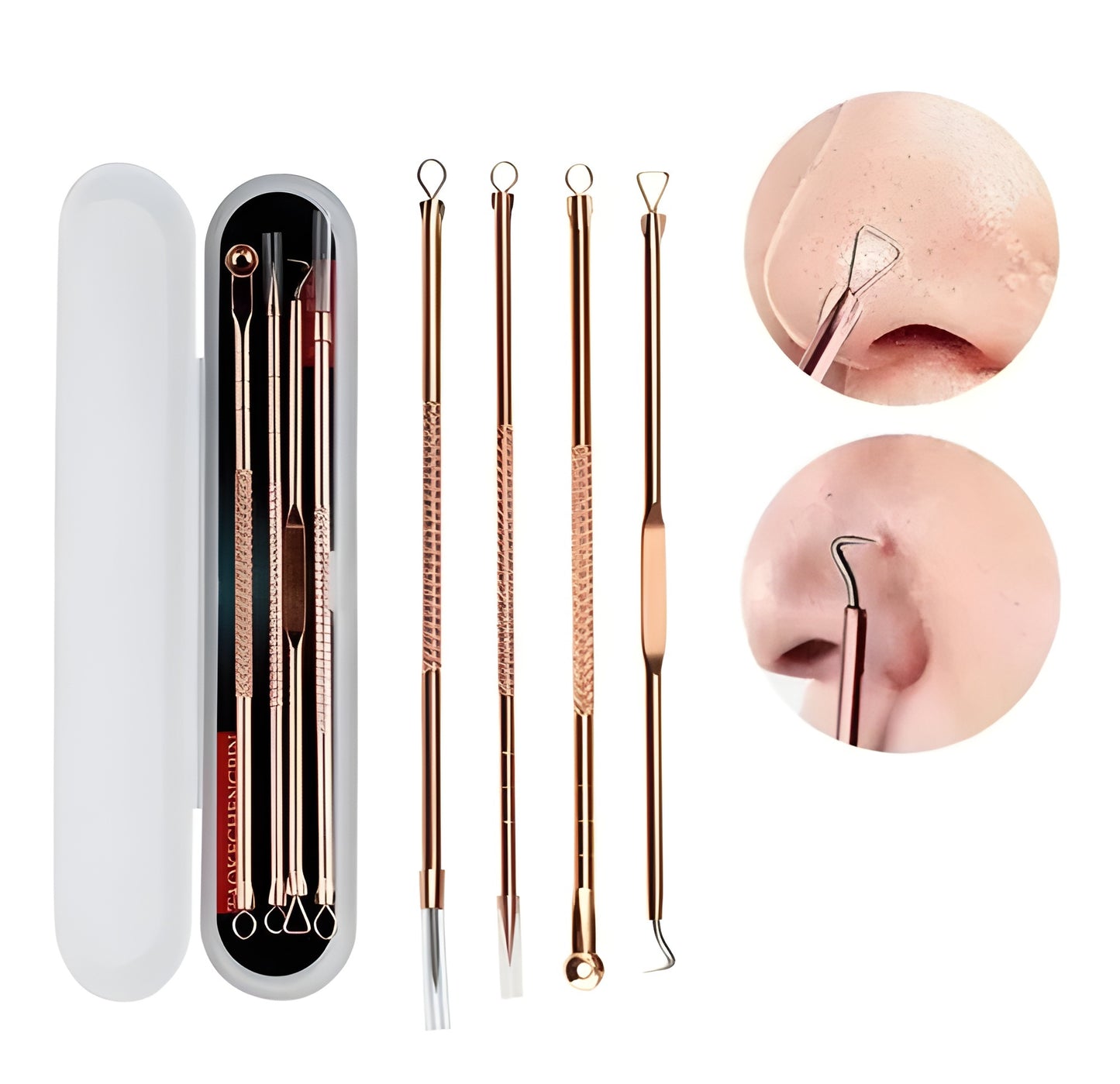 ⭐ Limpiador de Puntos Negros Profesional – Kit Extractor Facial 4 Piezas